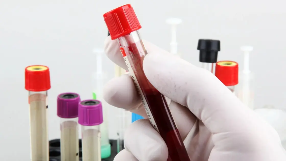 Do They Drain Blood Before Cremation? Debunking Common Myths